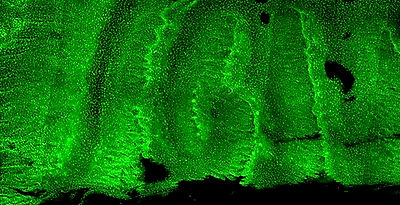 k5-tta_teto-h2b-gfp_uclear_tissues_p28_0_day_chase-gfp_whole_mount_agarose_170226_whole_palate_edited_